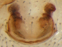 Mermessus jona female epigynum