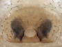 Grammonota trivittata female epigynum