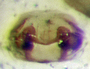 Cheniseo sphagnicultor female epigynum