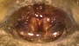 Scotinotylus alienus female epigynum