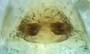 Spirembolus chilkatensis female epigynum