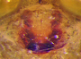 Mermessus tenuipalpis female epigynum