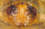 Diplocephalus picinus female epigynum