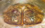 Diplocephalus sphagnicola female epigynum