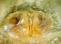 Scotinotylus gracilis female epigynum
