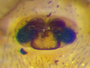 Ceratinops sylvaticus female epigynum
