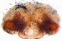 Walckenaeria microspiralis female epigynum
