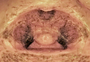 Ceratinella ornatula alaskana female epigynum
