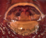 Pelecopsis moesta female epigynum