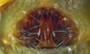 Ceraticelus innominabilis female epigynum