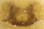 Walckenaeria placida female epigynum