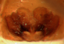 Ceraticelus artemisiae female epigynum