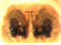 Ceraticelus bryantae female epigynum