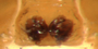 Ceraticelus paludigena female epigynum