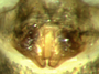 Diplocephalus subrostratus female epigynum