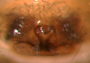 Dismodicus alticeps female epigynum