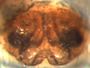 Gnathonarium suppositum female epigynum