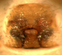 Grammonota vittata female epigynum