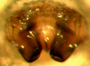Mermessus trilobatus female epigynum