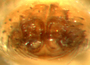 Pocadicnemis pumila female epigynum