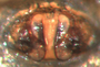 Sisis rotundus female epigynum