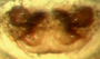 Spirembolus redondo female epigynum