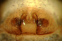 Walckenaeria auranticeps female epigynum