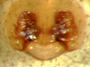 Walckenaeria minuta female epigynum