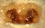Walckenaeria spiralis female epigynum
