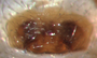 Walckenaeria subdirecta female epigynum