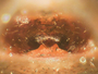 Arcterigone pilifrons female epigynum