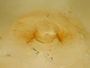 Tapinocyba bicarinata female epigynum
