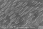 Acrobolbus, lophocoleoides, sem surfaces, JEB03265, x10000