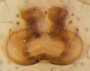 Mermessus index female epigynum