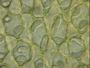 Blepharidophyllum, oil bodies, David Glenny,