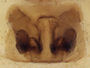 Ceratinopsis atolma female epigynum