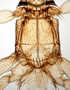 824789 Anastrebla spurrelli, male, holotype, thorax, dorsal view