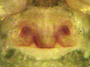 Horcotes uncinatus female epigynum