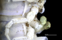 1165 cf. Gauchoma missionis male, holotype, gonopods, lateral view UV