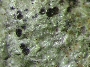 Gyalideopsis pseudoactinoplaca image