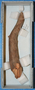 187321.1 wood stick for medicine
