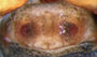 Walckenaeria redneri female epigynum