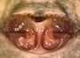Scotinotylus protervus female epigynum
