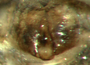 Blestia sarcocuon female epigynum