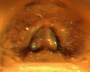 Ceraticelus carinatus female epigynum