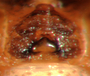 Ceraticelus laetabilis female epigynum