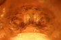 Ceraticelus micropalpis female epigynum