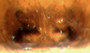 Ceraticelus phylax female epigynum