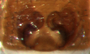 Ceraticelus pygmaeus female epigynum