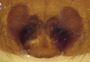 Ceraticelus rowensis female epigynum